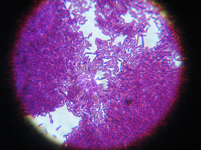 Bakterie Lactobacillus 1